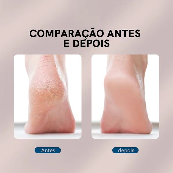 Lixa Elétrica para Calos e Rachaduras - Maxevolution©️